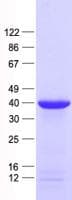 Human GAX / MEOX2 Protein (Recombinant His, N-Terminal)