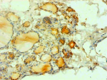 CALCA Antibody (clone 4G1H7)