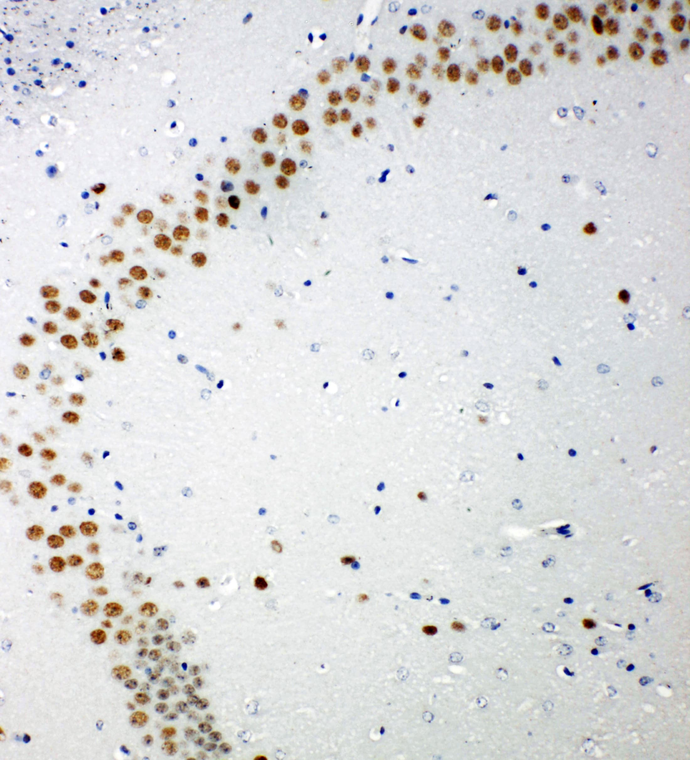 TP53BP1 / 53BP1 Antibody (aa1955-1972)