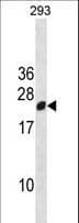 Polyclonal Rabbit anti-Human RGS13 Antibody (aa61-90, WB)