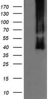 MAP2K3 / MEK3 / MKK3 Antibody (clone OTI3C8)