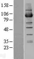 NSUN2 Protein (Over-Expression Lysate Myc-DDK (Flag))