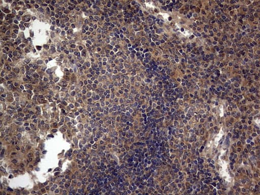 Monoclonal Mouse anti-Human ARAF / ARAF1 / A-RAF Antibody (clone OTI2G9, aa145-365, IHC, WB)