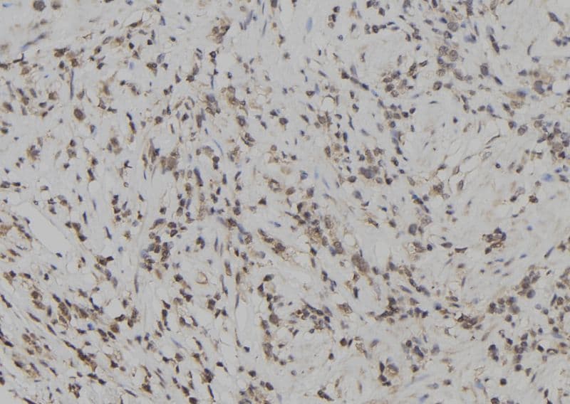 Polyclonal Rabbit anti-Human SKAP2 / SCAP2 Antibody (IHC, IF, WB)