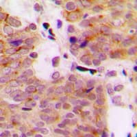 MAP3K1 / MEKK1 Antibody (phospho-T1402)