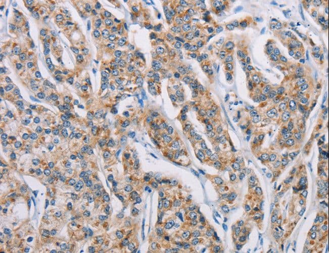 ATP2C1 Antibody