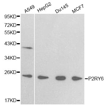 Polyclonal Rabbit anti-Human P2RY6 / P2Y6 Antibody (IHC, WB)