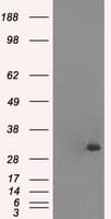 TNNI3 / Cardiac Troponin I Antibody (clone OTI4A3)