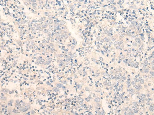 ADGRE3 / EMR3 Antibody