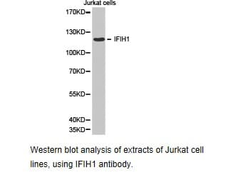 IFIH1 / MDA5 Antibody