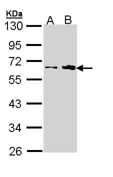 IHC-plus™ FKTN / Fukutin Antibody