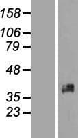 XRCC2 Protein (Over-Expression Lysate Myc-DDK (Flag))