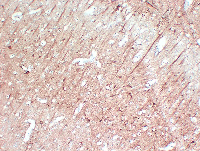 NF-L / NEFL Antibody (clone ABT-NF)