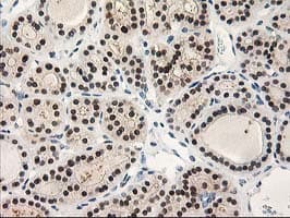 TP53I3 / PIG3 Antibody (clone OTI3B11, Carrier-free)
