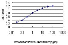 BRD2 / RING3 Antibody (clone 3D10)