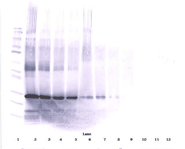 OSM / Oncostatin M Antibody