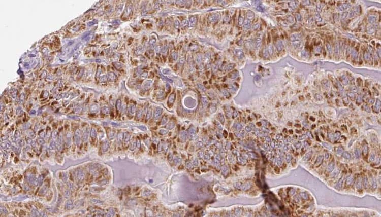 Polyclonal Rabbit anti-Human SHMT / SHMT1 Antibody (IHC, WB)