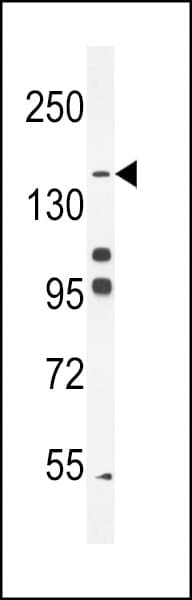 Polyclonal Rabbit anti-Human PTPRJ / CD148 Antibody (IHC, IF, WB)