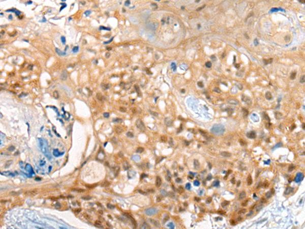 CBR3 Antibody