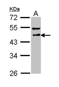 Polyclonal Rabbit anti-Human DLST / E2 Antibody (aa188-453, IHC, WB)