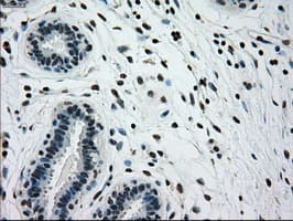 Monoclonal Mouse anti-Human GCK / Glucokinase Antibody (clone OTI3E3, IHC, IF, WB)