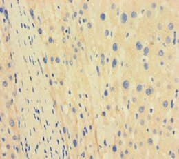 TBPL1 / TRF2 Antibody (aa1-185)