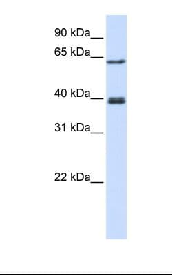 IKZF3 / AIOLOS Antibody (C-Terminus, FITC)