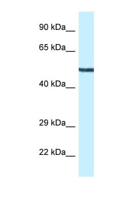 MAP2K5 / MEK5 Antibody (aa142-191)