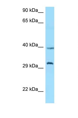 Polyclonal Rabbit anti-Human GHSR / Ghrelin Receptor Antibody (C-Terminus, WB)