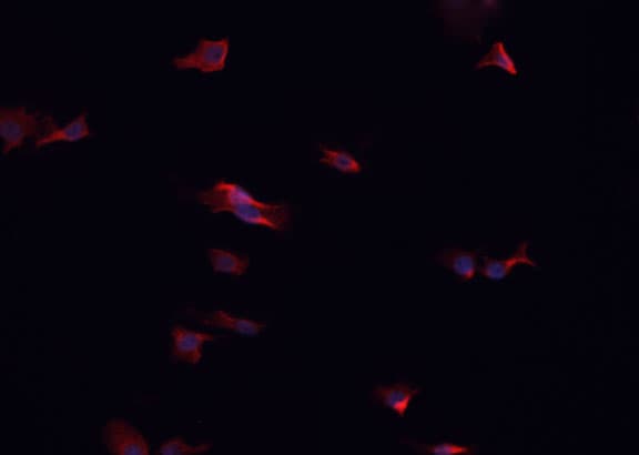KRT7 / CK7 / Cytokeratin 7 Antibody