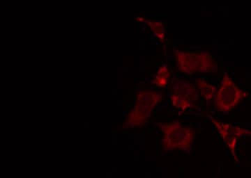 Polyclonal Rabbit anti-Human CA5A / Carbonic Anhydrase VA Antibody (IF, WB)