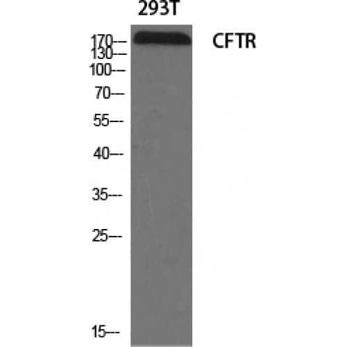 IHC-plus™ CFTR Antibody (680-760 aa)