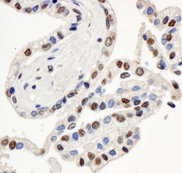 SMARCE1 / BAF57 Antibody (aa360-C-term)