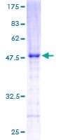 Human RERG Protein (Recombinant GST)
