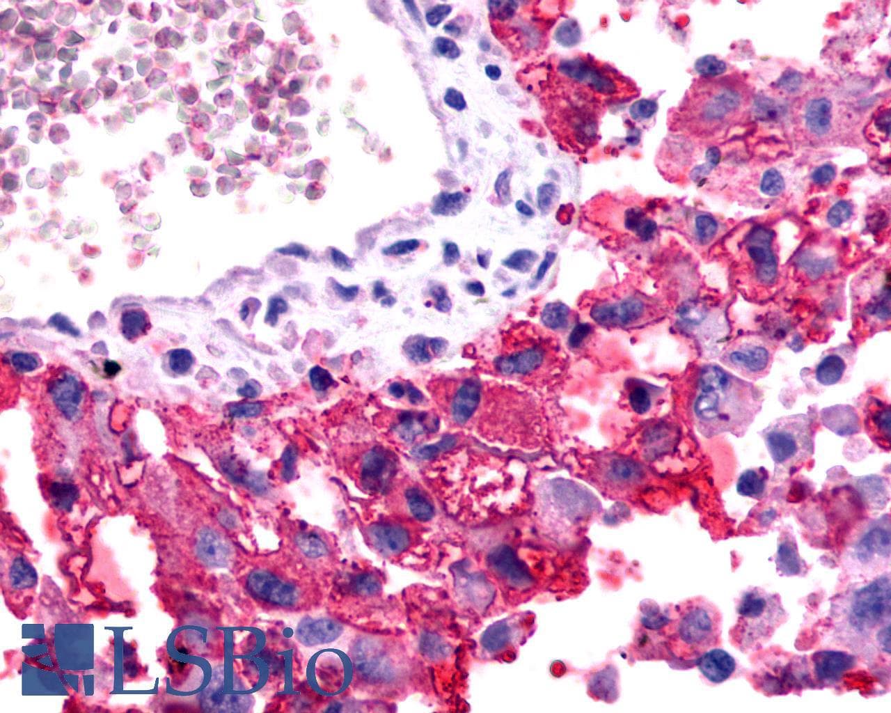 IHC-plus™ Polyclonal Rabbit anti-Human FZD2 / Frizzled 2 Antibody (N-Terminus, IHC)