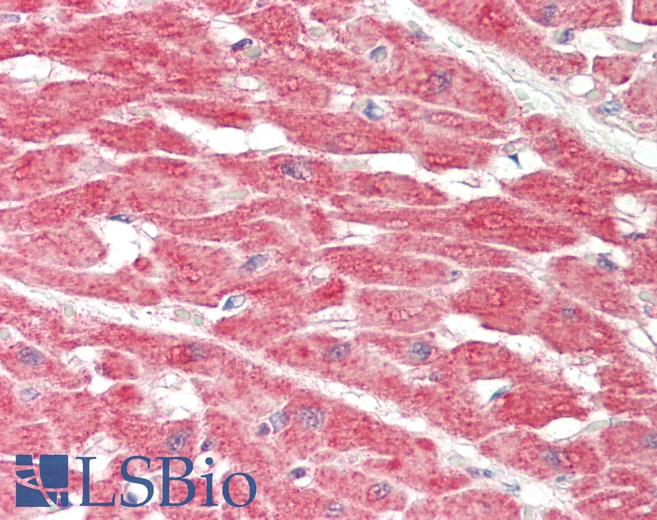 Polyclonal Rabbit anti-Human SLC6A2 / NET Antibody (aa396-445, IHC, WB)