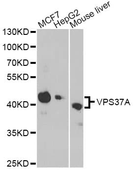 Polyclonal Rabbit anti-Human VPS37A Antibody (IHC, IF, WB)