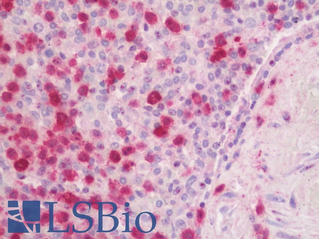 IHC-plus™ FGR Antibody (clone 3G10)