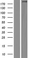 COL14A1 / Collagen XIV Protein (Over-Expression Lysate Myc-DDK (Flag))
