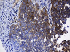 Monoclonal Mouse anti-Human TSC22D1 / TSC22 Antibody (clone OTI1G1, IHC, WB)