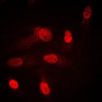 SGK1 / SGK Antibody (Internal)