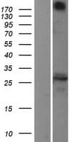 TMED10 / TMP21 Protein (Over-Expression Lysate Myc-DDK (Flag))