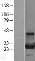 RAB13 Protein (Over-Expression Lysate Myc-DDK (Flag))