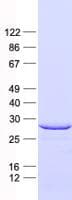 Human STC1 / Stanniocalcin Protein (Recombinant His, N-Terminal)