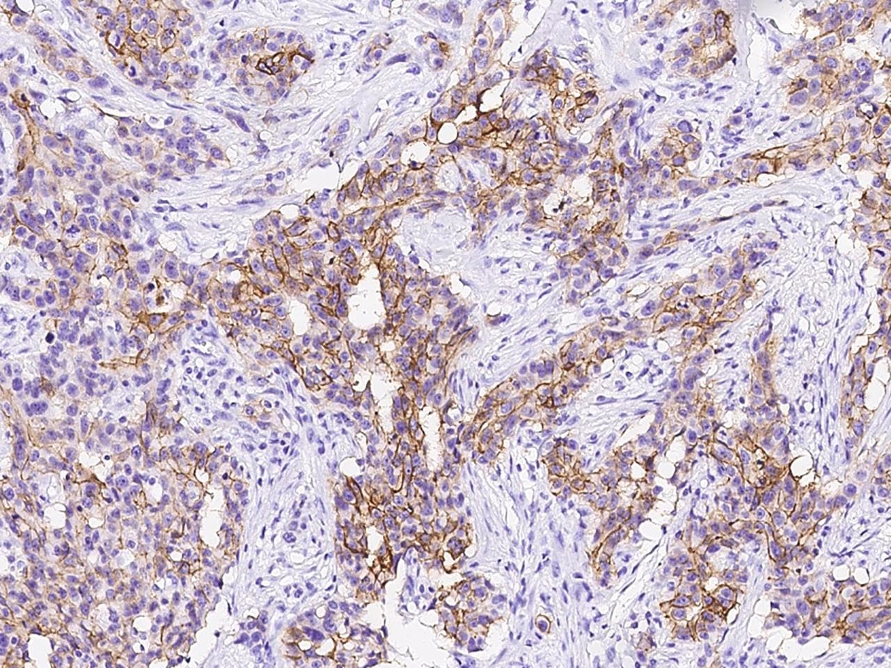 TROP2 / TACSTD2 Antibody
