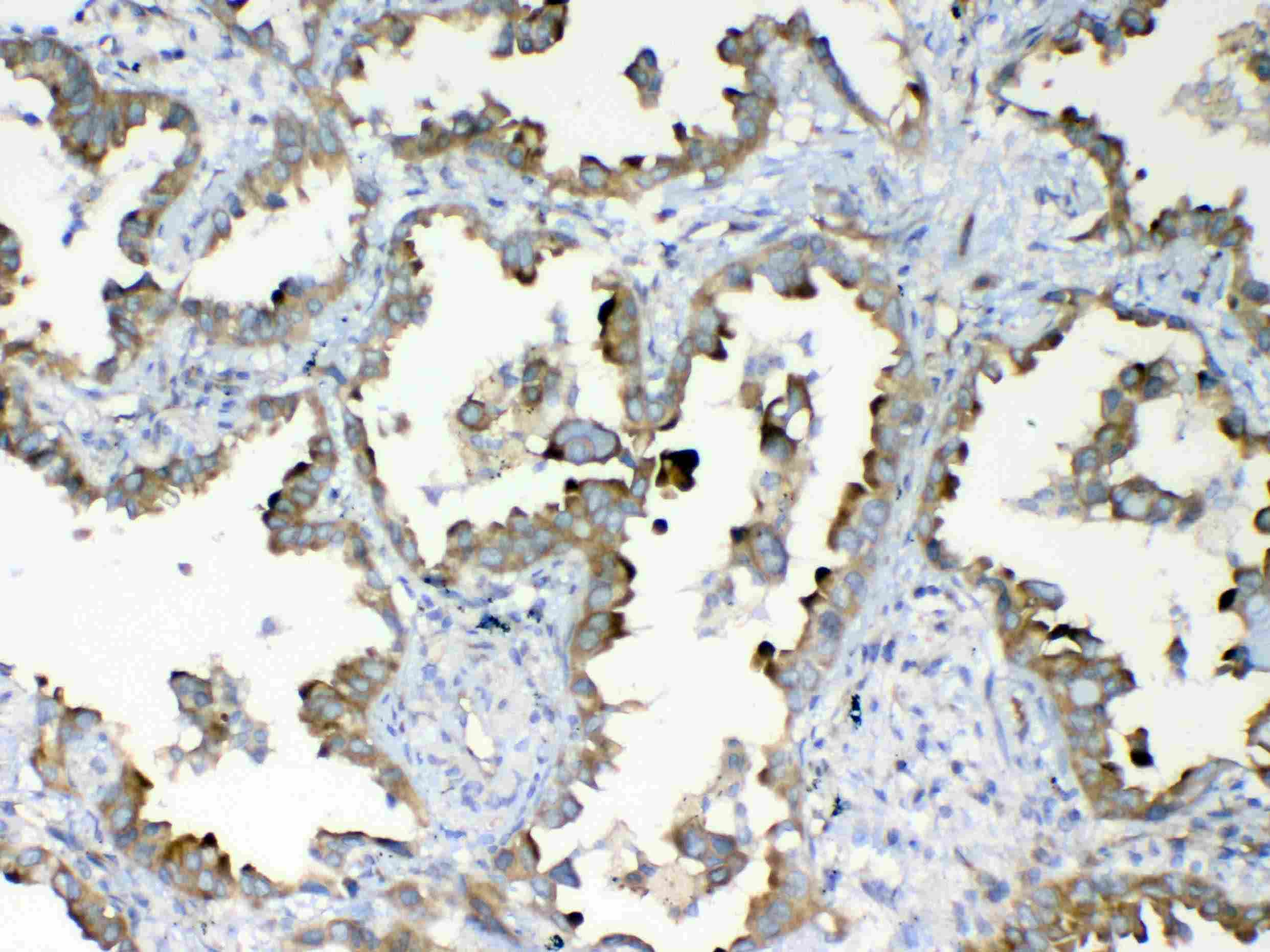 Polyclonal Rabbit anti-Human DYNLT1 / TCTEX-1 Antibody (IHC, WB)