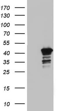 BFSP2 Antibody (aa184-415, clone OTI4D3, Carrier-free)