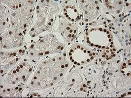 LOX / Lysyl Oxidase Antibody (clone OTI9G2)
