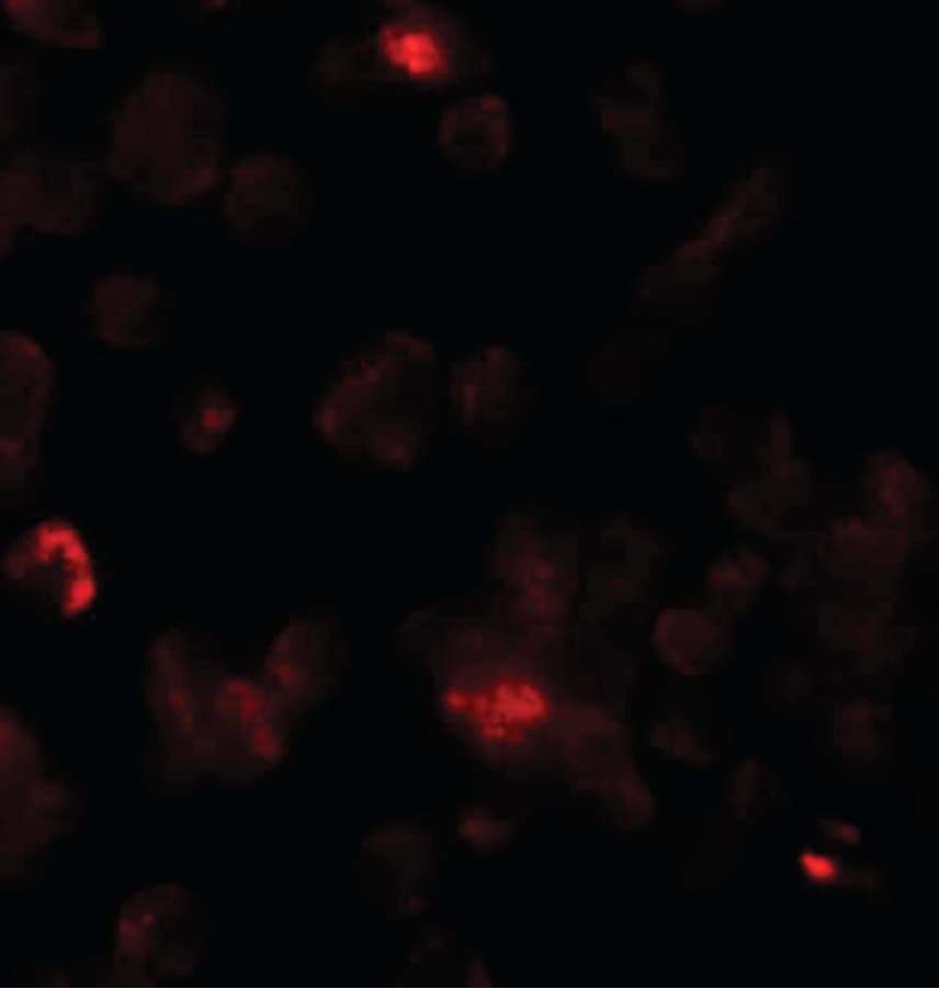 IHC-plus™ Rho Kinase / ROCK1 Antibody
