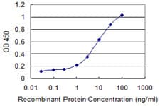 Monoclonal Mouse anti-Human CAPN3 / Calpain 3 Antibody (clone 1B2, IF, WB)